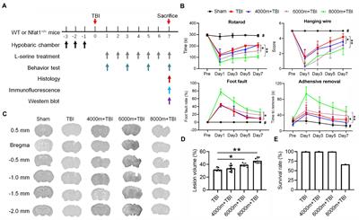 Neuroinflammation aggravated by traumatic brain injury at high altitude is reversed by L-serine via NFAT1-mediated microglial polarization